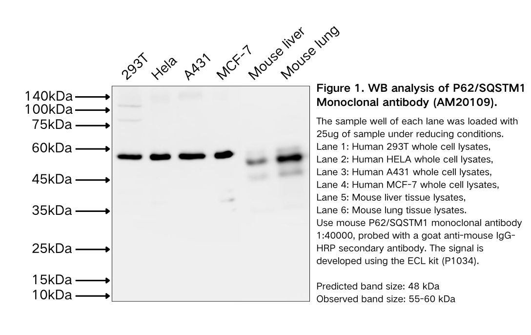 P62/SQSTM1 Monoclonal antibody