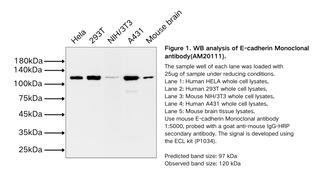 E-cadherin Monoclonal antibody