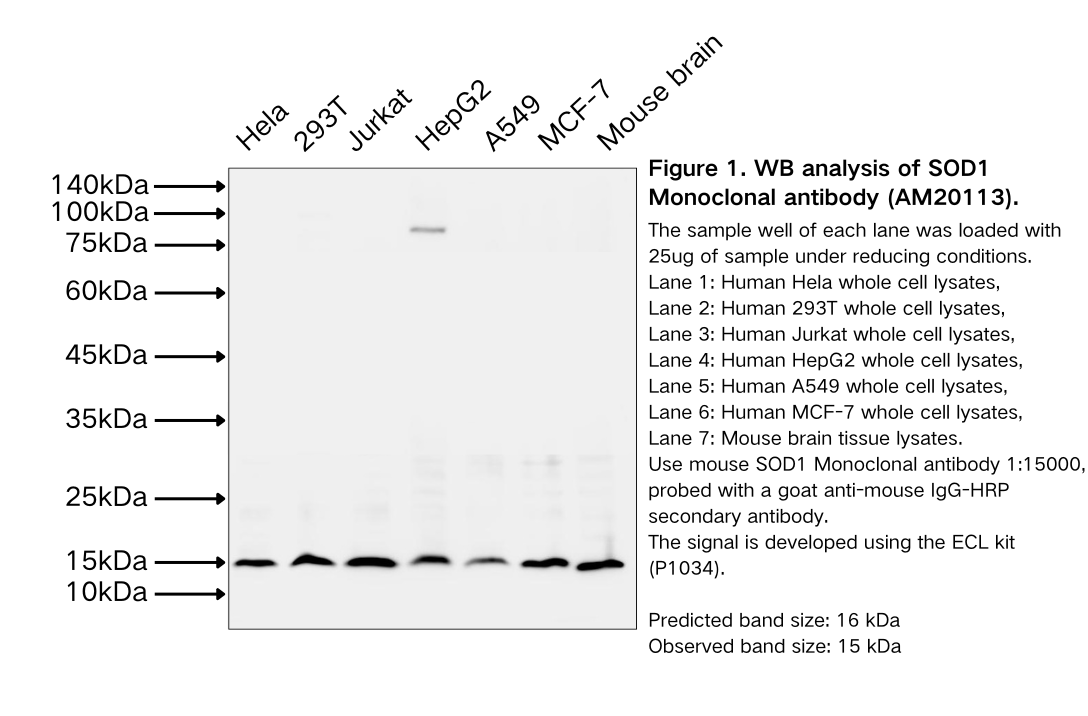 SOD1 Monoclonal antibody