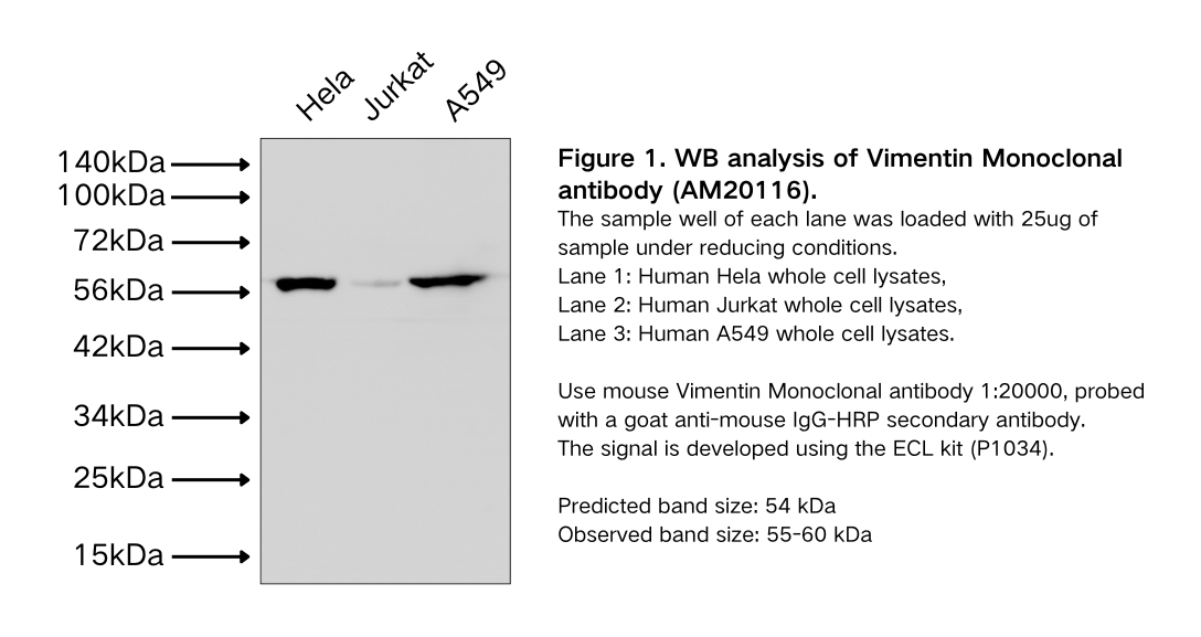 Vimentin Monoclonal antibody