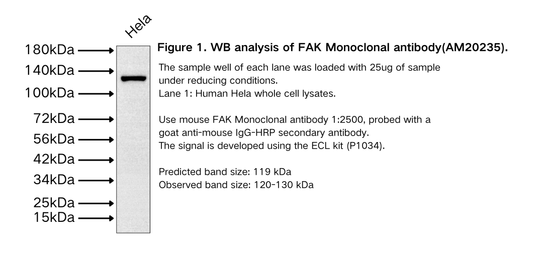 FAK Monoclonal antibody