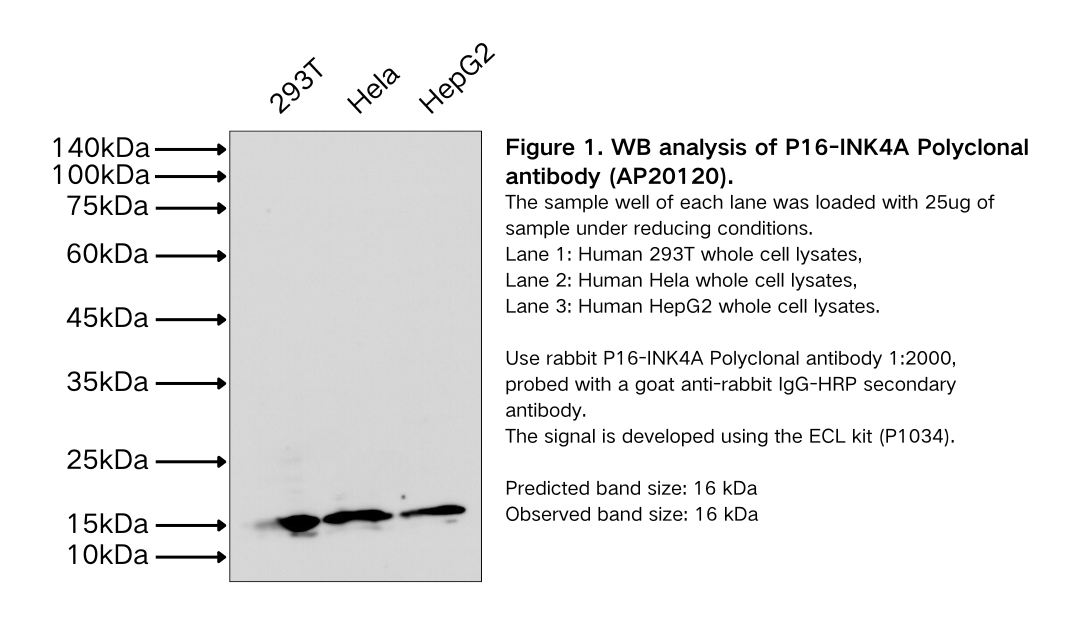 P16-INK4A Polyclonal antibody