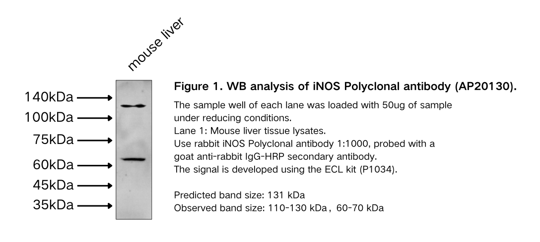 iNOS Polyclonal antibody