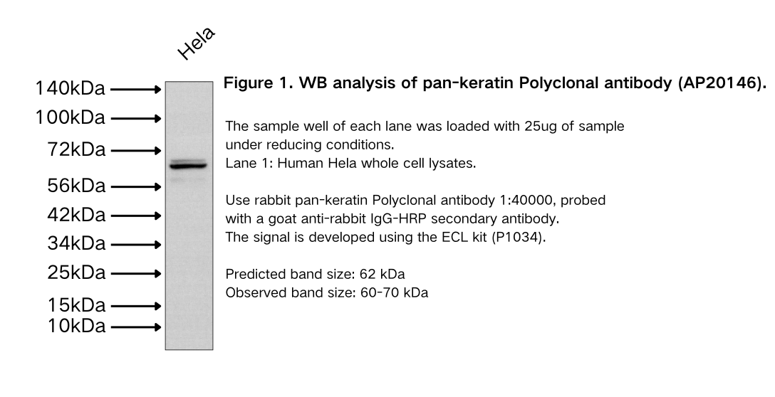 pan-keratin Polyclonal antibody