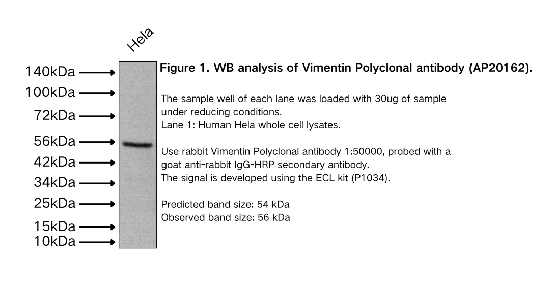 Vimentin Polyclonal antibody