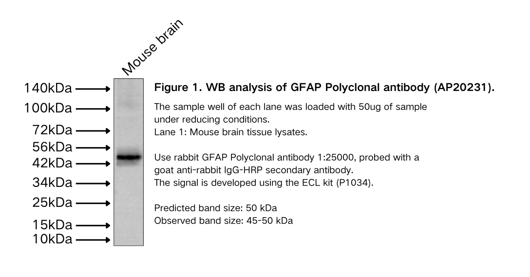 GFAP Polyclonal antibody