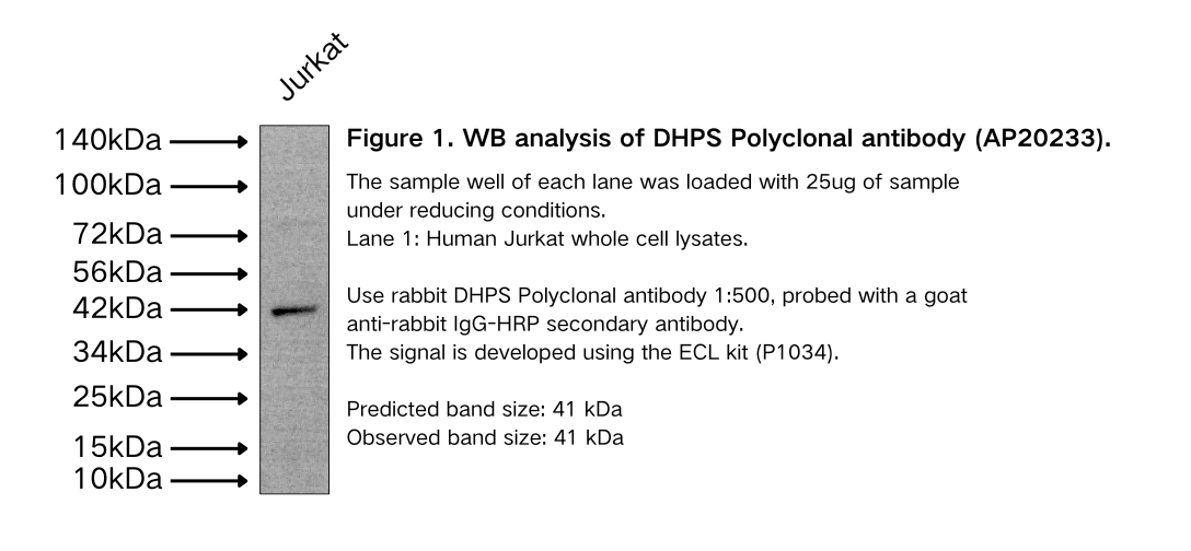 DHPS Polyclonal antibody