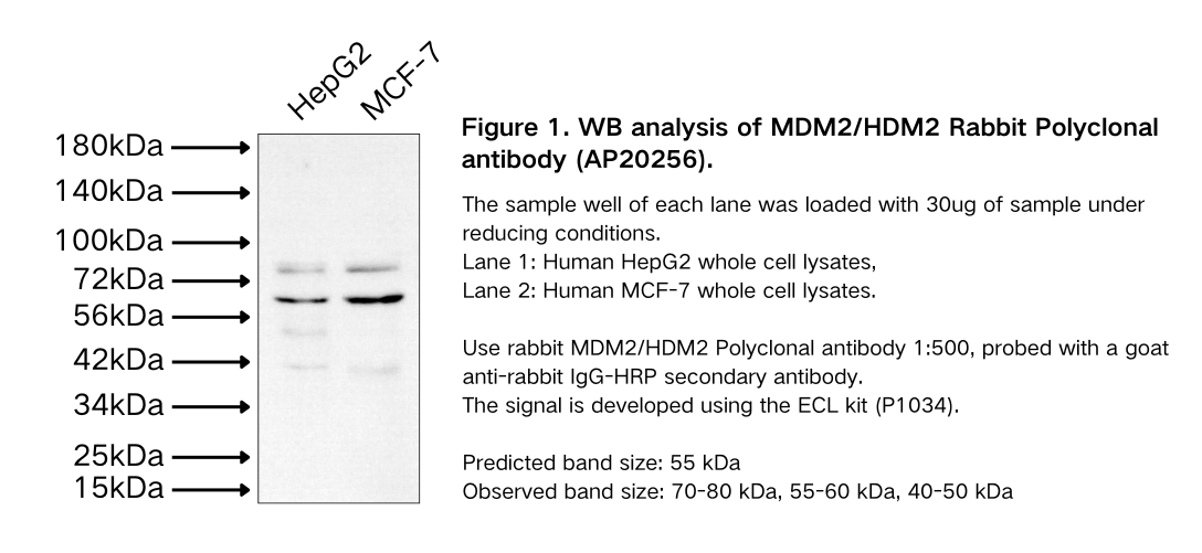 MDM2/HDM2 Rabbit Polyclonal antibody