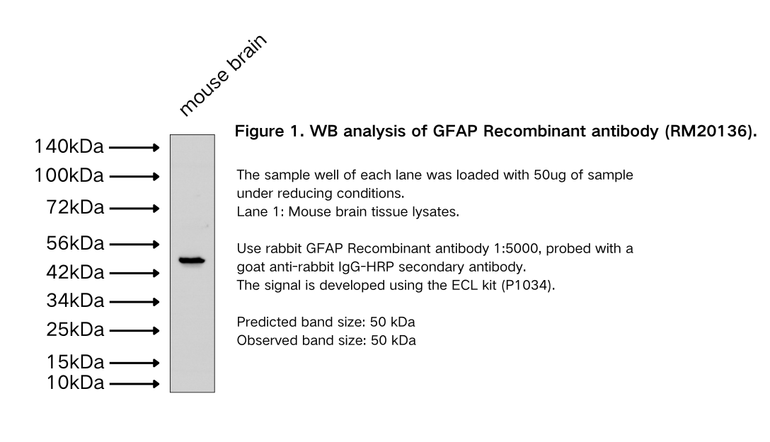GFAP Recombinant antibody