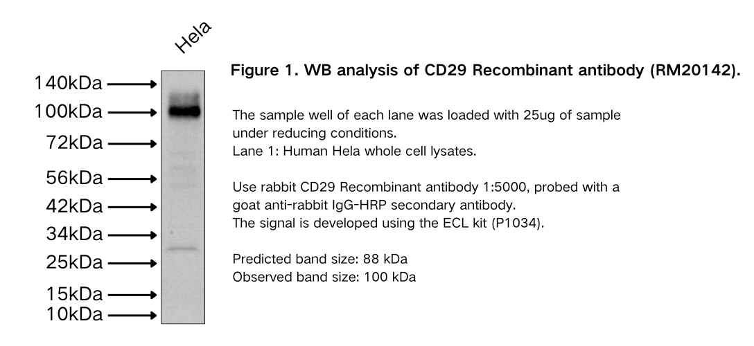 CD29 Recombinant antibody