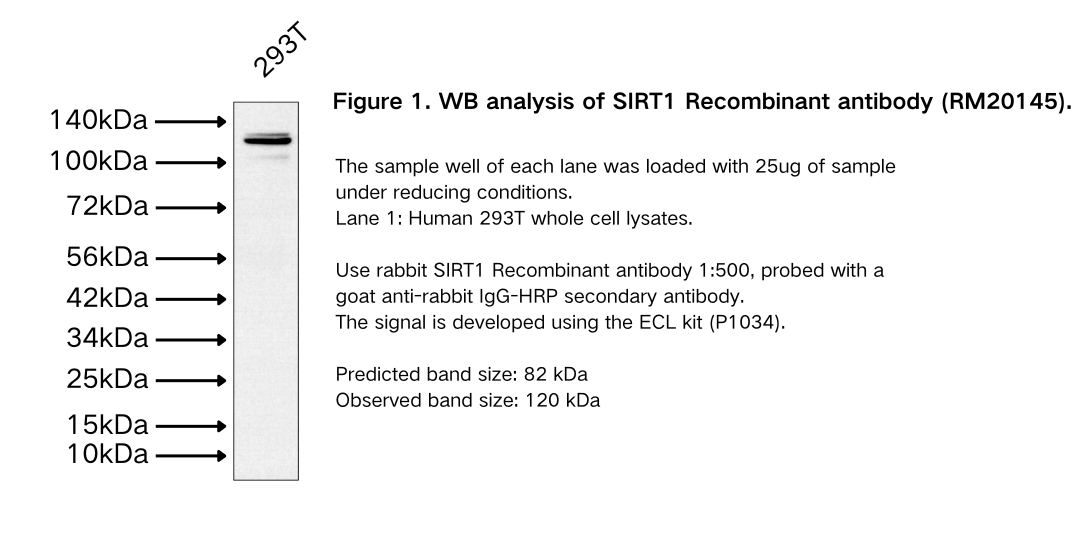 SIRT1 Recombinant antibody