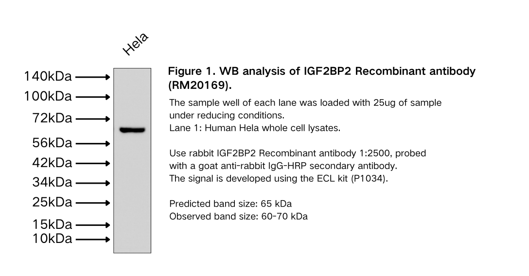 IGF2BP2 Recombinant antibody
