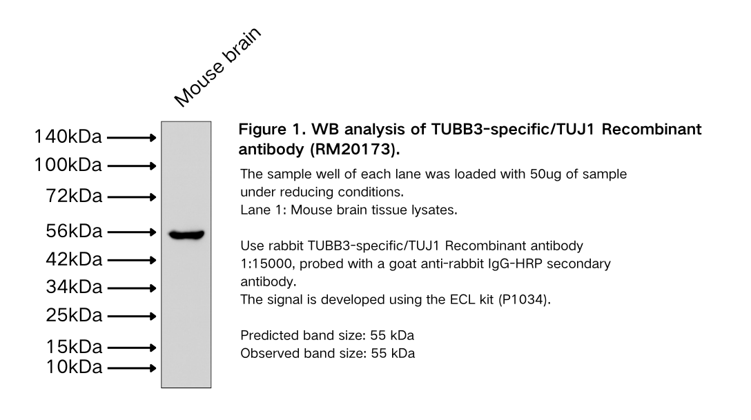 TUBB3-specific/TUJ1 Recombinant antibody