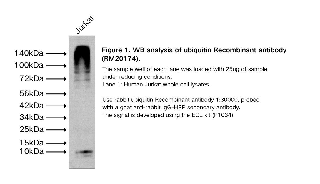 ubiquitin Recombinant antibody