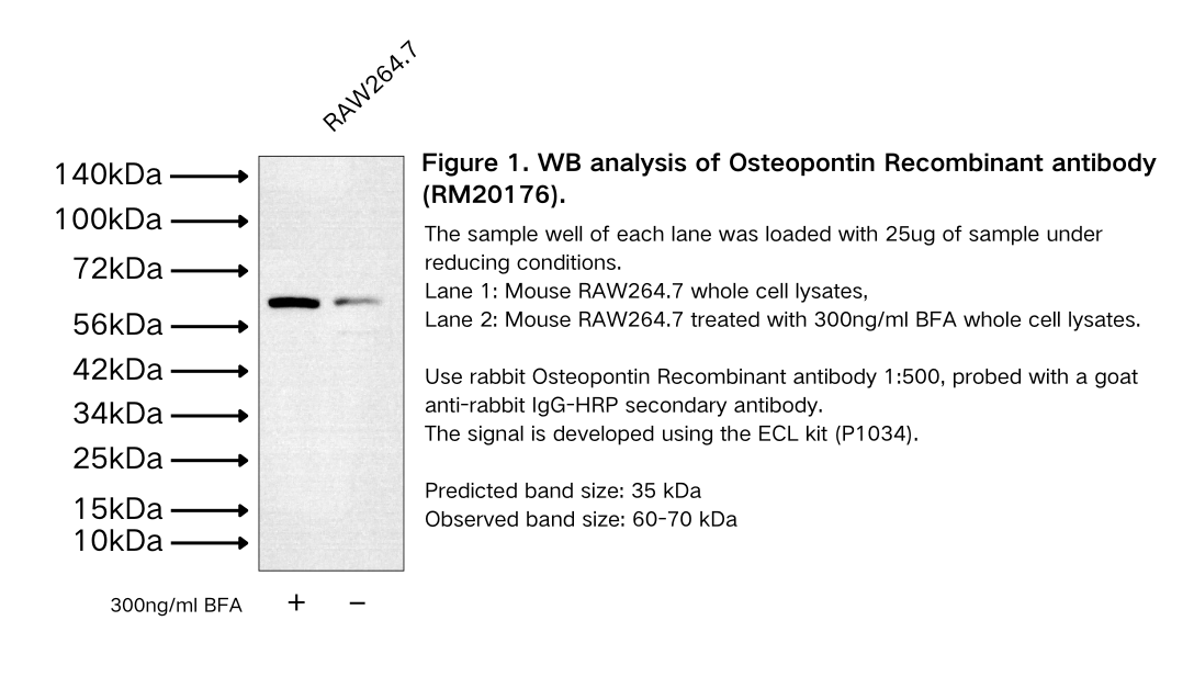 Osteopontin Recombinant antibody