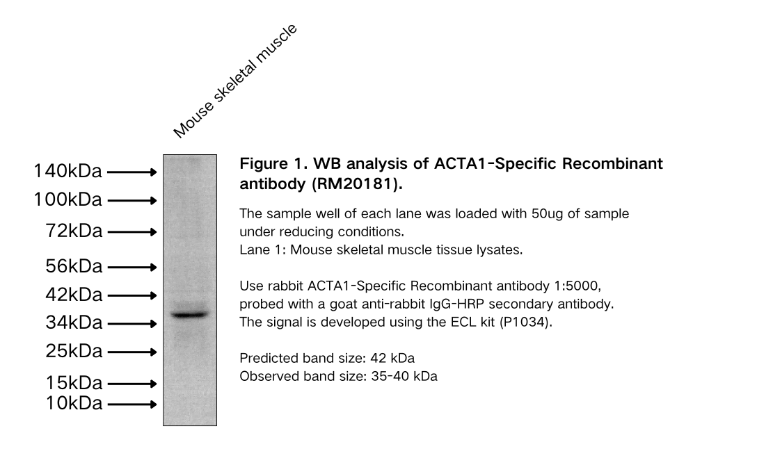 ACTA1-Specific Recombinant antibody