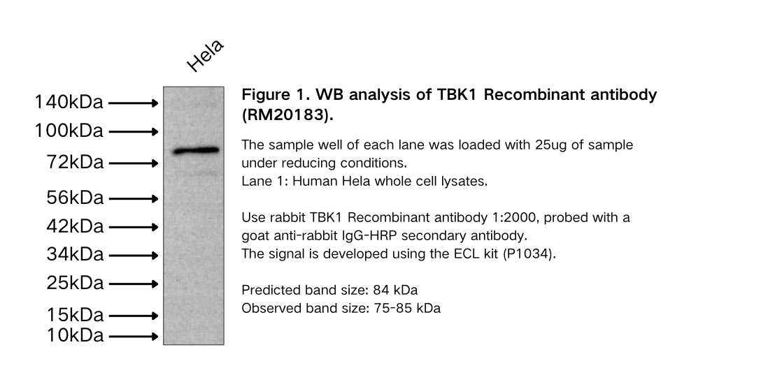 TBK1 Recombinant antibody