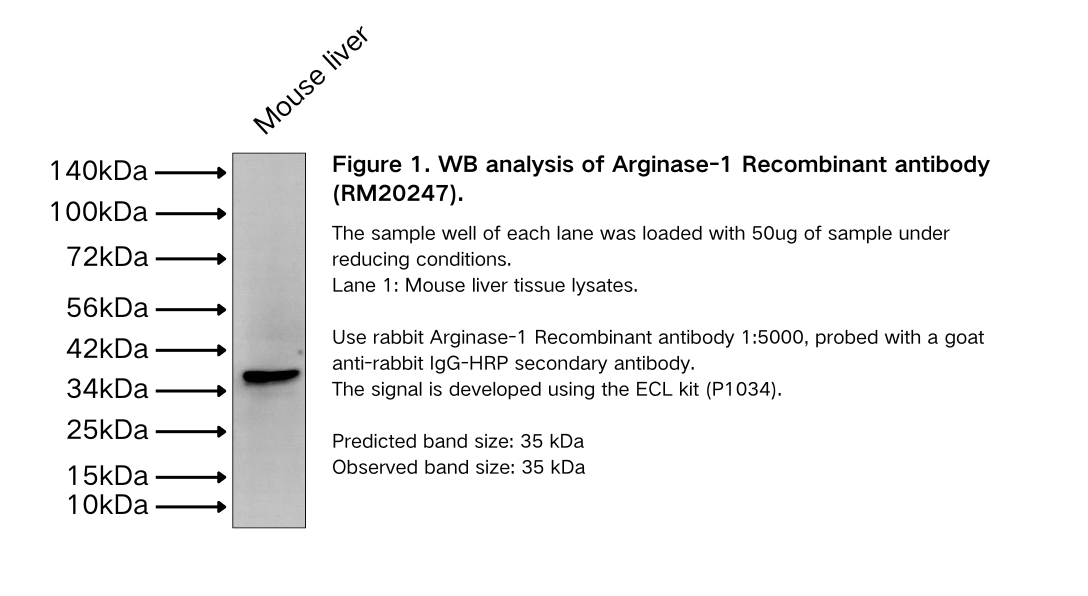 Arginase-1 Recombinant antibody